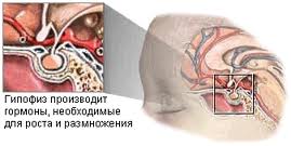 КИБЕР-НОЖ – АДЕНОМА ГИПОФИЗА КИБЕР-НОЖ – АДЕНОМА ГИПОФИЗА